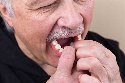 Loose Dentures And The Problems They Cause Gordon Dental Implants