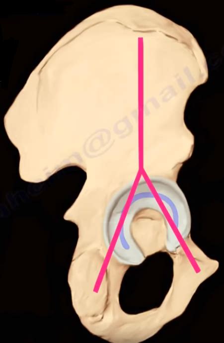 Anatomy Of The Acetabulum The Column Principle Divides The By Nabil