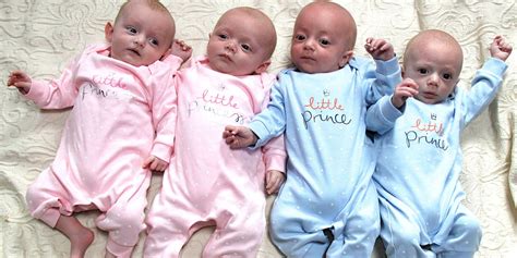 Quadruplet Babies Born From Four Separate Eggs Miracle Baby And