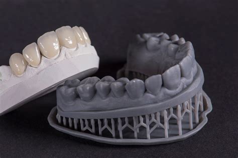 Four Features Of The Best 3d Printer For Dental Models Luxcreo