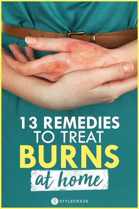 How To Treat Burns At Home 13 Natural Remedies To Try Home Remedies For Burns Burn Remedy