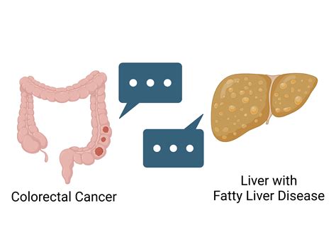 how fatty liver disease helps cancer thrive in the liver nci