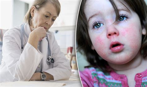 Outbreak Of Scarlet Fever Feared After Rise In Cases Uk