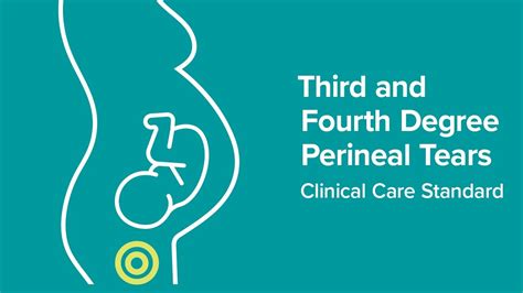 Launch Of The Third And Fourth Degree Perineal Tears Clinical Care