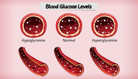 Hypoglycemia Causes