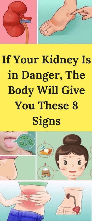 If Your Kidney Is In Danger The Body Will Give You These 8 Signs