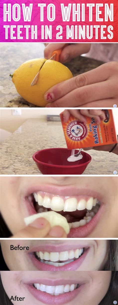 How To Get Your Teeth Really White In A Day Teeth Poster