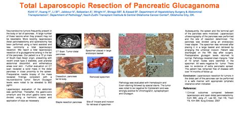 Total Laparoscopic Resection Of Pancreatic Glucagonoma Case Report