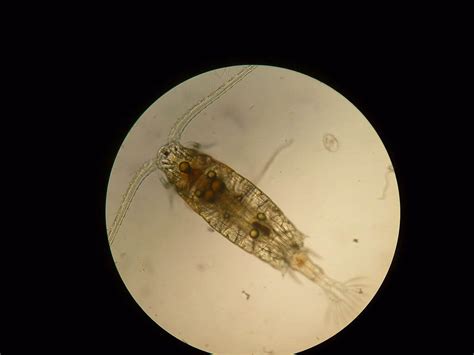 Nematodes Copepods And Oocystis Oh My The Microscape Of Timberline
