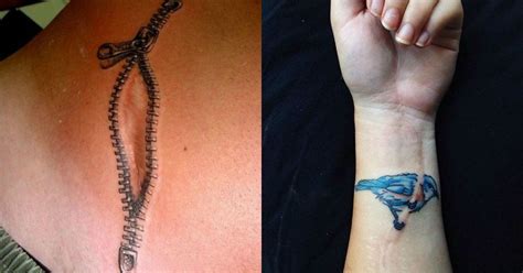29 Amazing Scar Cover Up Tattoos That Will Blow You Away