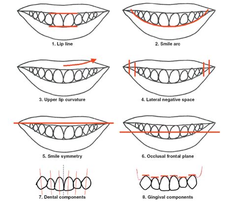 Our Results Jaw Alignment Bovenizer And Baker Orthodontics In Cary Nc