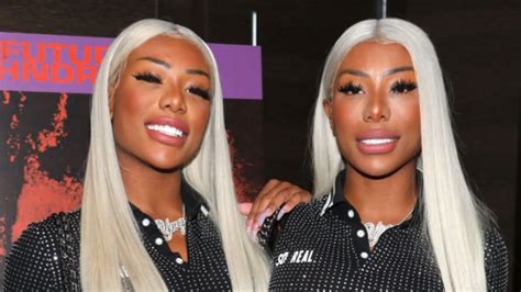How Did Clermont Twins Look Before Plastic Surgery After Photos