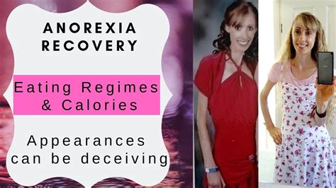 Anorexia Recovery Eating Regimes And Calories Appearances Can Be