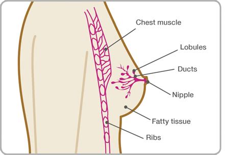 Most early breast cancers are diagnosed on screening mammograms before a lump can be felt. Duct ectasia | Breast Cancer Now