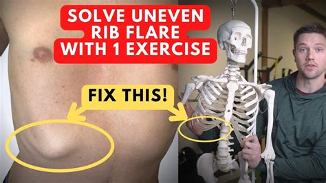 How To Fix Uneven Rib Flare With 1 Exercise Youve Never Tried This