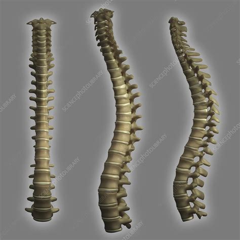 Spinal Anatomy Artwork Stock Image C020 4556 Science Photo Library