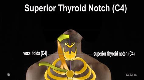 Surface Anatomy Anterior Neck Triangle 2d Youtube