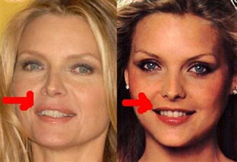 Michelle Pfeiffer Plastic Surgery Well We Are Going To Talk About Her