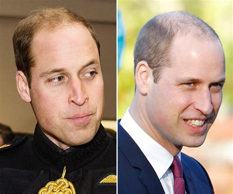 Prince william, duke of cambridge kg kt adc(p) (william arthur philip louis; PICS Prince William's Hair: Duke Of Cambridge Shows Off ...