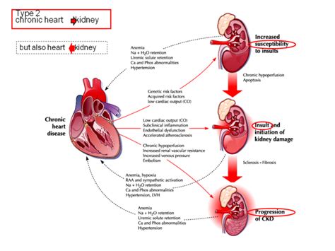 Heart failure in chronic kidney disease: Chronic Kidney Disease & Cardiovascular Disease