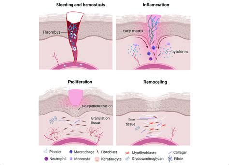 Wound Healing Process Once The Wound Is Formed Inflammatory Cells