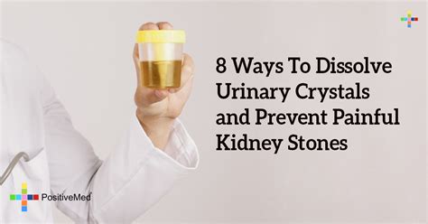 8 Ways To Dissolve Urinary Crystals And Prevent Painful Kidney Stones