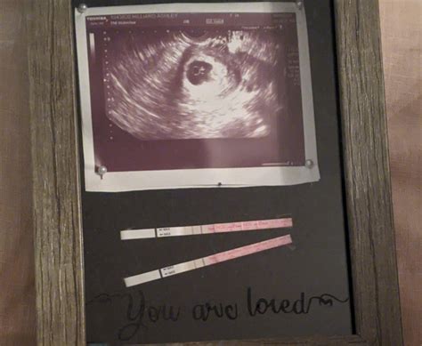 Miscarriage And Pregnancy Loss Ashley’s Story