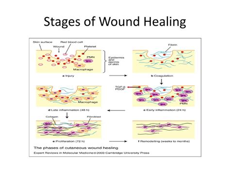 Photos Of Wound Healing Stages