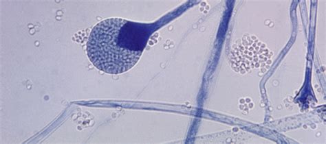It was first identified in december 2019 in wuhan,. Índia: pacientes pós-covid-19 são infectados com um fungo ...