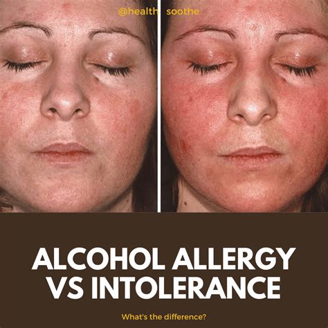 Alcohol Allergy Vs Intolerance Whats The Difference
