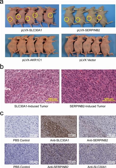 Xenograft Tumor Formation In Nude Mice Of Nih T Cells Ectopically And