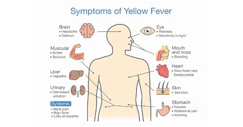 yellow fever symptoms causes prevention and treatments