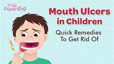 Blisters On Toddlers Lips And Tongue