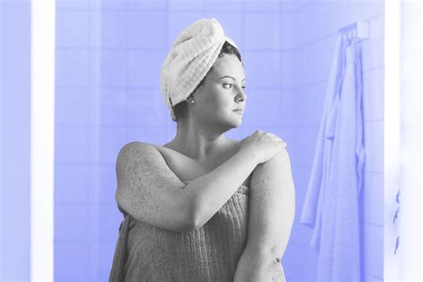 what causes itchy skin after a shower
