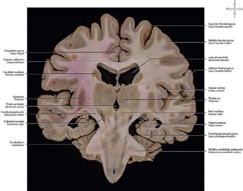 27 Brain Sections Neupsy Key