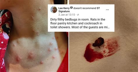 Jalan Besar Hotel Guest Disagrees That Bed Bug Incident Was Isolated