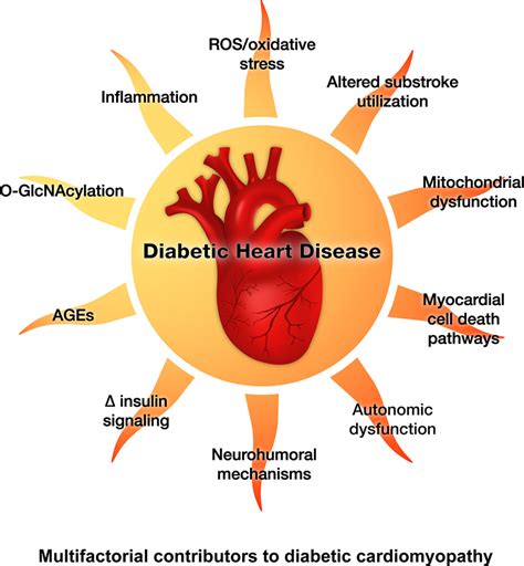 Basic Mechanisms Of Diabetic Heart Disease Circulation Research