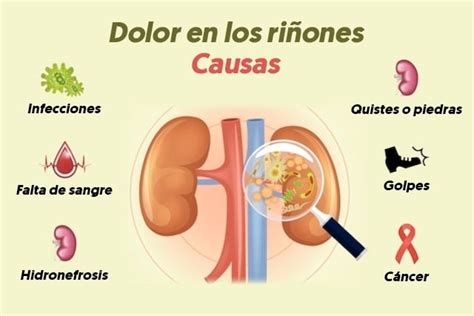 Dolor En Los Riñones Causas Síntomas Tratamientos Remedios Y Mucho Más