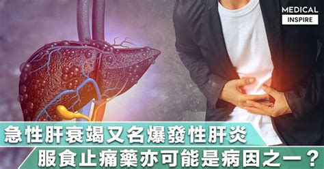 慢性肝衰竭急性发作（acute on chronic liver failure，简称aclf）是指有慢性肝衰竭的病患出现急性的症状。 【認識疾病】急性肝衰竭又名爆發性肝炎，患者只能靠肝臟移植保命？ - Medical Inspire 醫・思維
