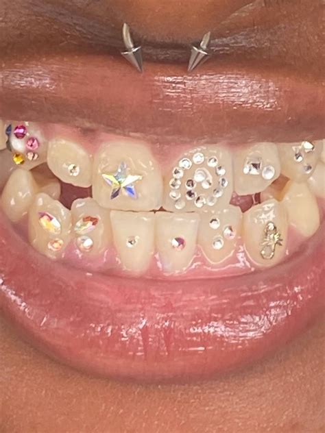 The History Of Tooth Gems The Latest Beauty Trend POPSUGAR Beauty