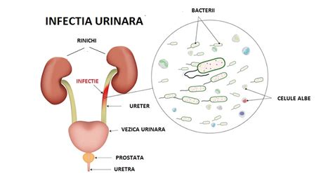 Infec Ia Urinar Cauze Si Simptome Fortius Medical