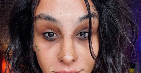 Linn Da Quebrada Mostra Resultado Da Cirurgia De Feminiza O Facial