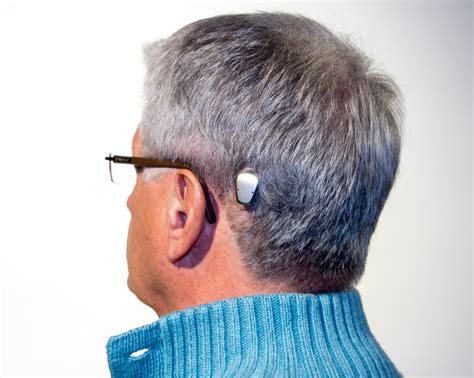 Bone Anchored Hearing Devices Better Hearing Jax
