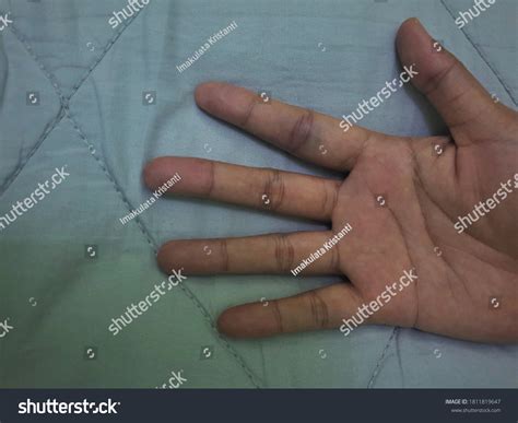 5752 Jammed Finger Images Stock Photos And Vectors Shutterstock