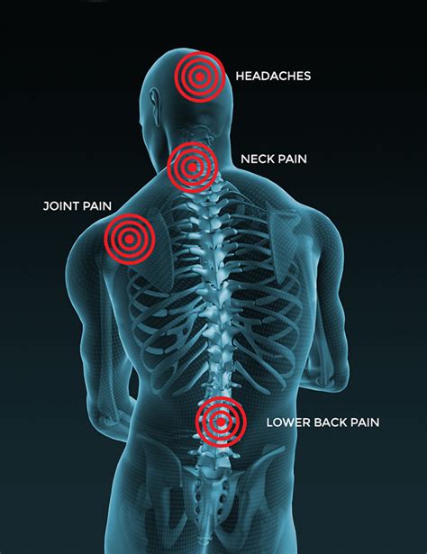 Head Neck And Back Care Spine Alignment Tyler Tx Mckinzie