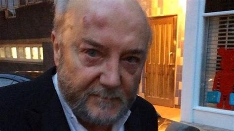 George Galloway Leaves Hospital After London Street Attack Bbc News