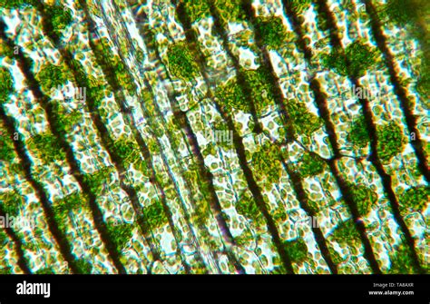 Chloroplasts In Elodea As Viewed Through A Microscope Magnified 100x