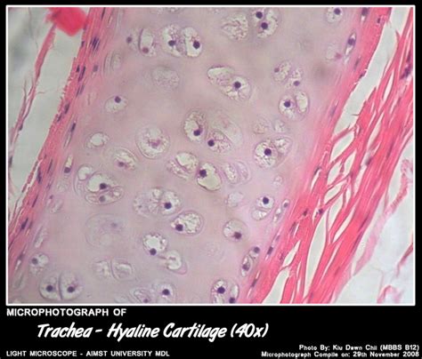 Histology Of Respiratory System Trachea My Aimst University