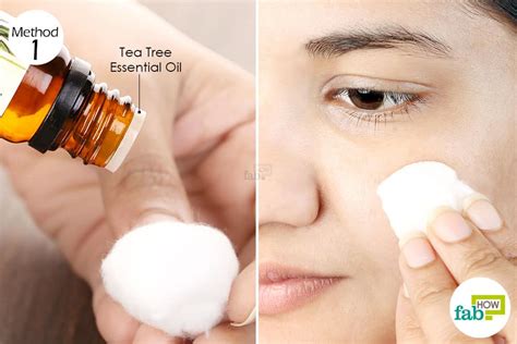 Using your clean ring finger, dip your finger in the dilution and gently dab a small amount on your pimples. How to Use Tea Tree Oil for Acne: 7 Popular Remedies | Fab How