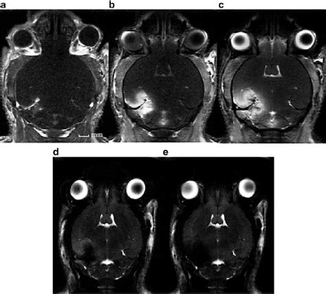 5 T1and T2 Magnetic Resonance Imaging Mri Scans Of A Single Mouse